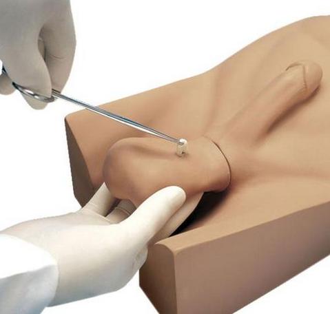 包头“康为医疗”新型输精管切除术（NSV）训练操作模型