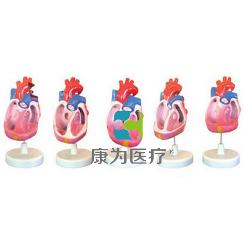 四平“康为医疗”先天性心脏畸形模型（5部件）