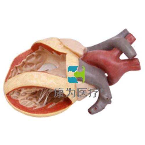 台州“康为医疗”心脏房室管畸形模型