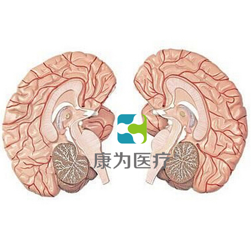 黔南“康为医疗”左右脑带脑动脉分布模型　2部件