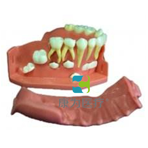 “康为医疗”牙列发育模型B