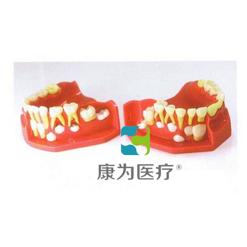 赤峰“康为医疗”乳牙交替模型