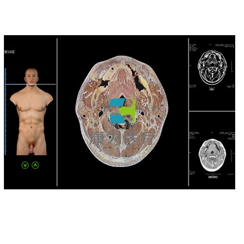 “康为医疗”断层解剖与断层影像虚拟教学系统