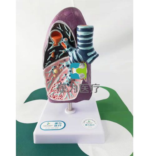 “康为医疗”人体肺部病理模型